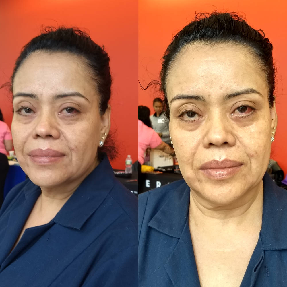 Before and After using perfect skin today for tight eyes 